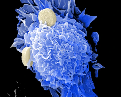 Mayo Clinic Weaponizes Milk Against Deadly Bile Duct Cancer