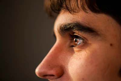 Profile view highlighting a non-surgical nose reshaping with natural-looking results.