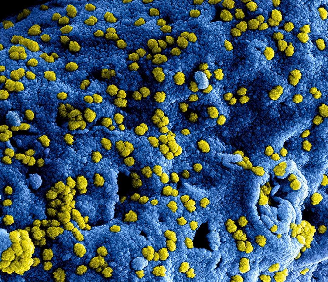 Produced by the National Institute of Allergy and Infectious Diseases (NIAID), this highly magnified, digitally colorized scanning electron microscopic (SEM) image, revealed ultrastructural details at the site of interaction of numerous yellow colored, Middle East respiratory syndrome coronavirus (MERS-CoV) viral particles, located on the surface of a Vero E6 cell, which had been colorized blue.