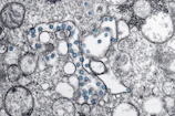 Abstract layered membrane structure with subtle cyan accents illustrating filtration pathways.