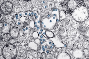 The image depicts a microscopic view of a cellular structure with numerous circular blue elements scattered throughout a textured, grayscale background. The scene resembles a cross-section of complex organic material with various bubble-like formations.