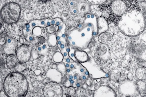 Abstract layered membrane structure with subtle cyan accents illustrating filtration pathways.