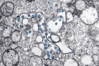 The image depicts a microscopic view of a cellular structure with numerous circular blue elements scattered throughout a textured, grayscale background. The scene resembles a cross-section of complex organic material with various bubble-like formations.