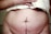 A close-up view of a person's abdomen with a prominent vertical scar. The skin appears slightly red and there is a towel partially covering the upper area while a hand rests on it.
