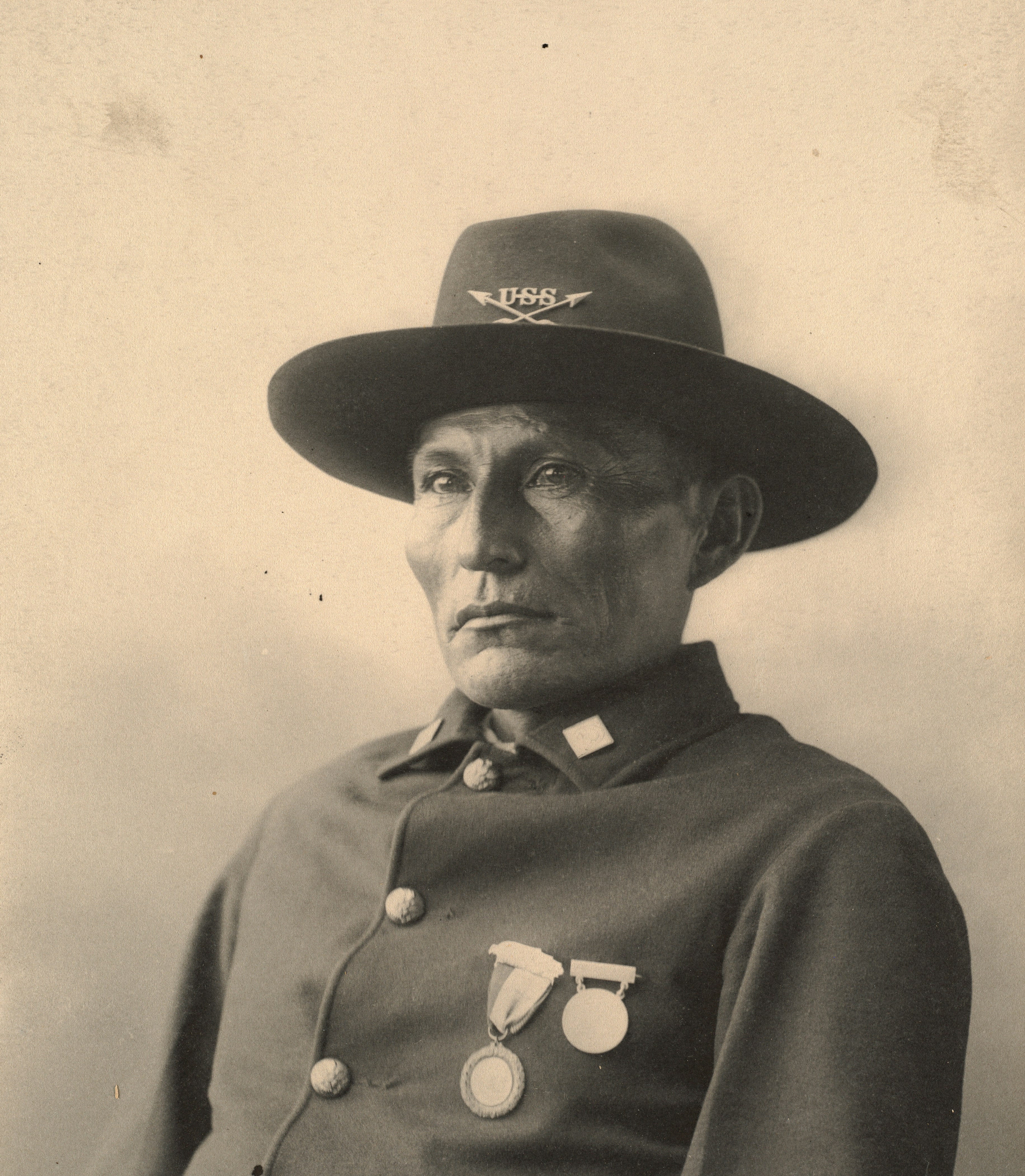 Understanding Why Symptoms Don't Always Correlate With Disease Severity