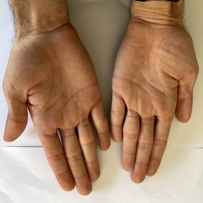 Two open hands with fingers slightly apart resting on a flat surface, with visible lines and creases on the palms.