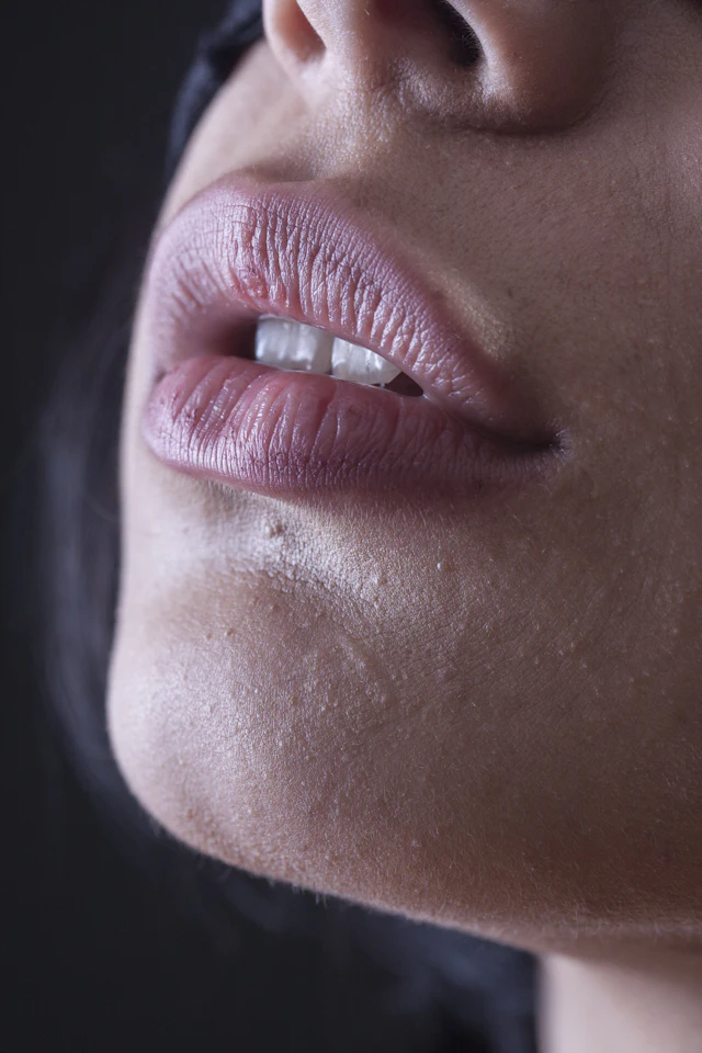 Soft, defined lips and facial features
