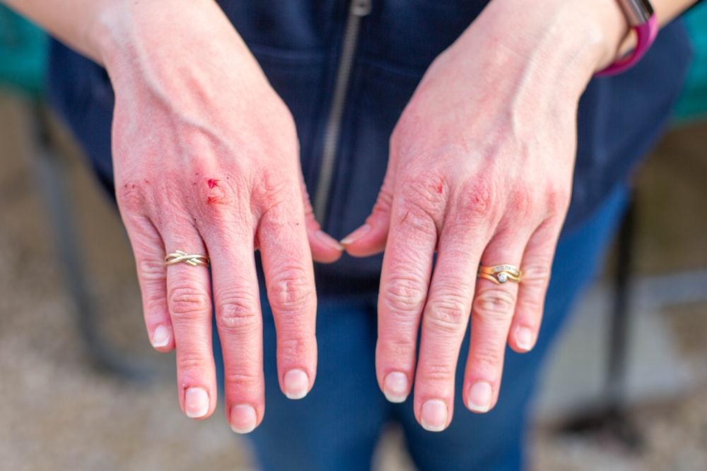 person wearing gold wedding band