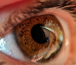 A close-up view of a human eye, showcasing intricate details of the iris and its texture. The pupil appears dilated, and reflections are visible on the surface of the eye, highlighting the eyelashes and some surrounding skin.