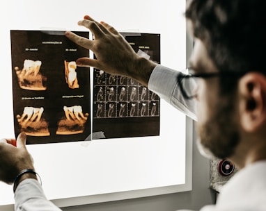 Dentist looking at x-rays of teeth.
