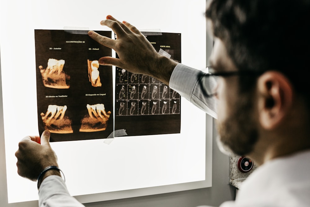 A photo showing a man holding up a dental X-Ray.