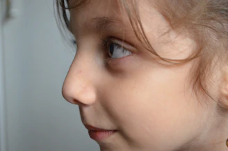 Side profile showing facial growth improvement in a pediatric patient