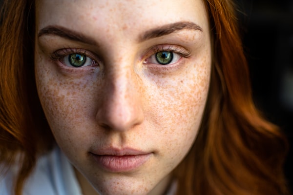 How To Treat Acne Vulgaris At Home Naturally