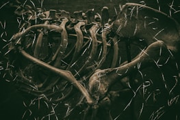 Forensic expert examining skeletal remains in a laboratory