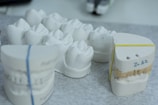 Plaster dental molds are arranged on a gray speckled surface. Some molds are stacked and secured with rubber bands, displaying detailed impressions of teeth.