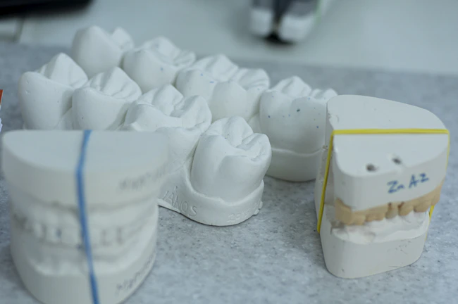 A set of custom nightguards neatly arranged on a clean dental lab bench.