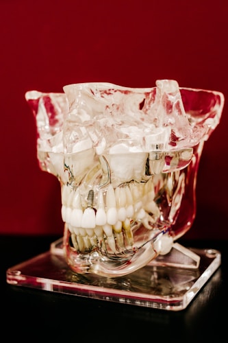 A transparent anatomical model of a human skull displayed on a clear stand. The model showcases detailed dental structures such as teeth, roots, and nerves, with metallic screws visible. The background is a deep red color.