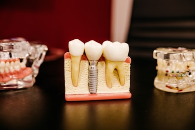 Root Canal & Implants