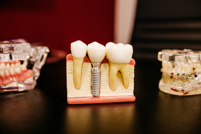 Dental model with a restored tooth on a white surface
