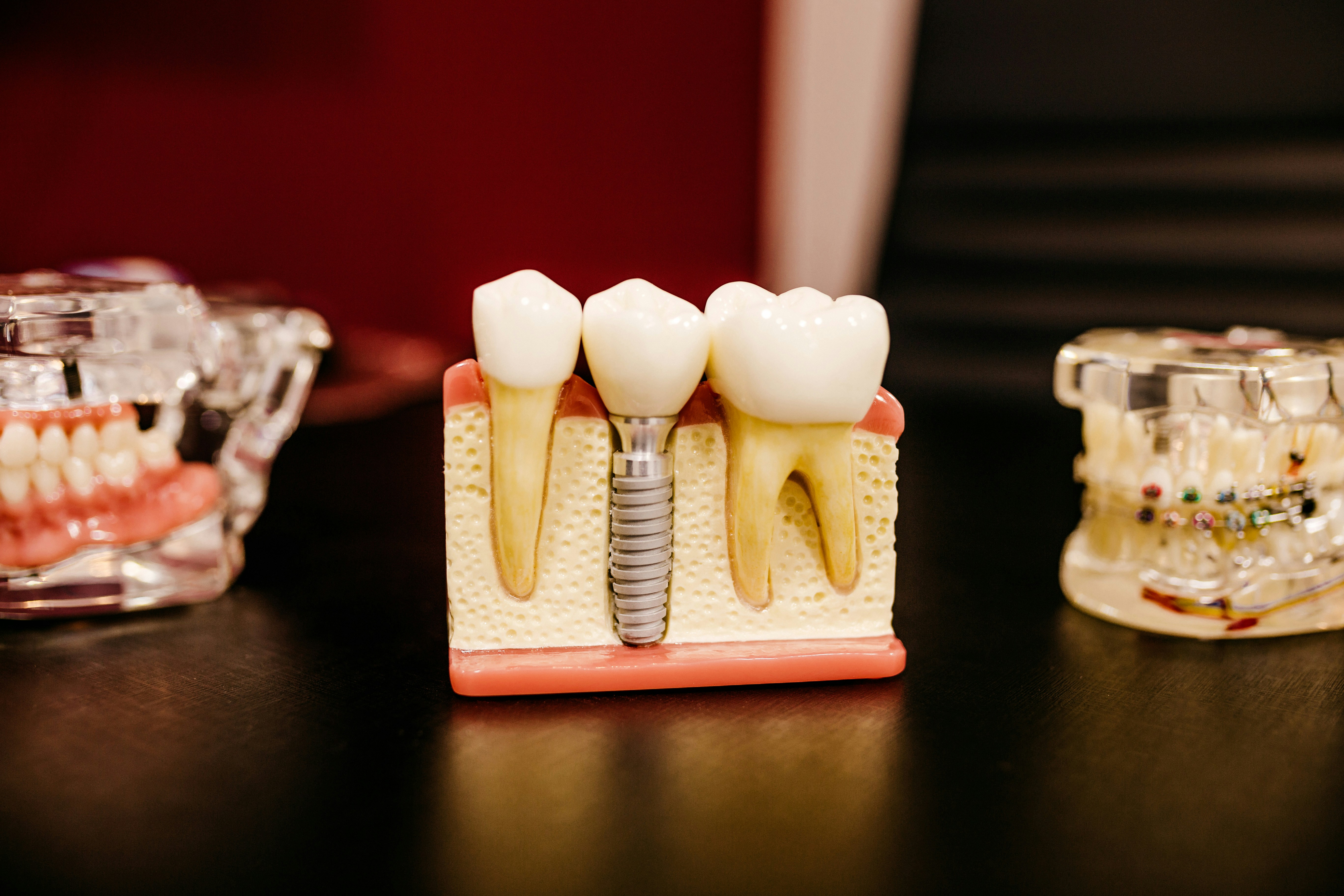 Cosmetic Dentist In Old Torrance California Calif CA