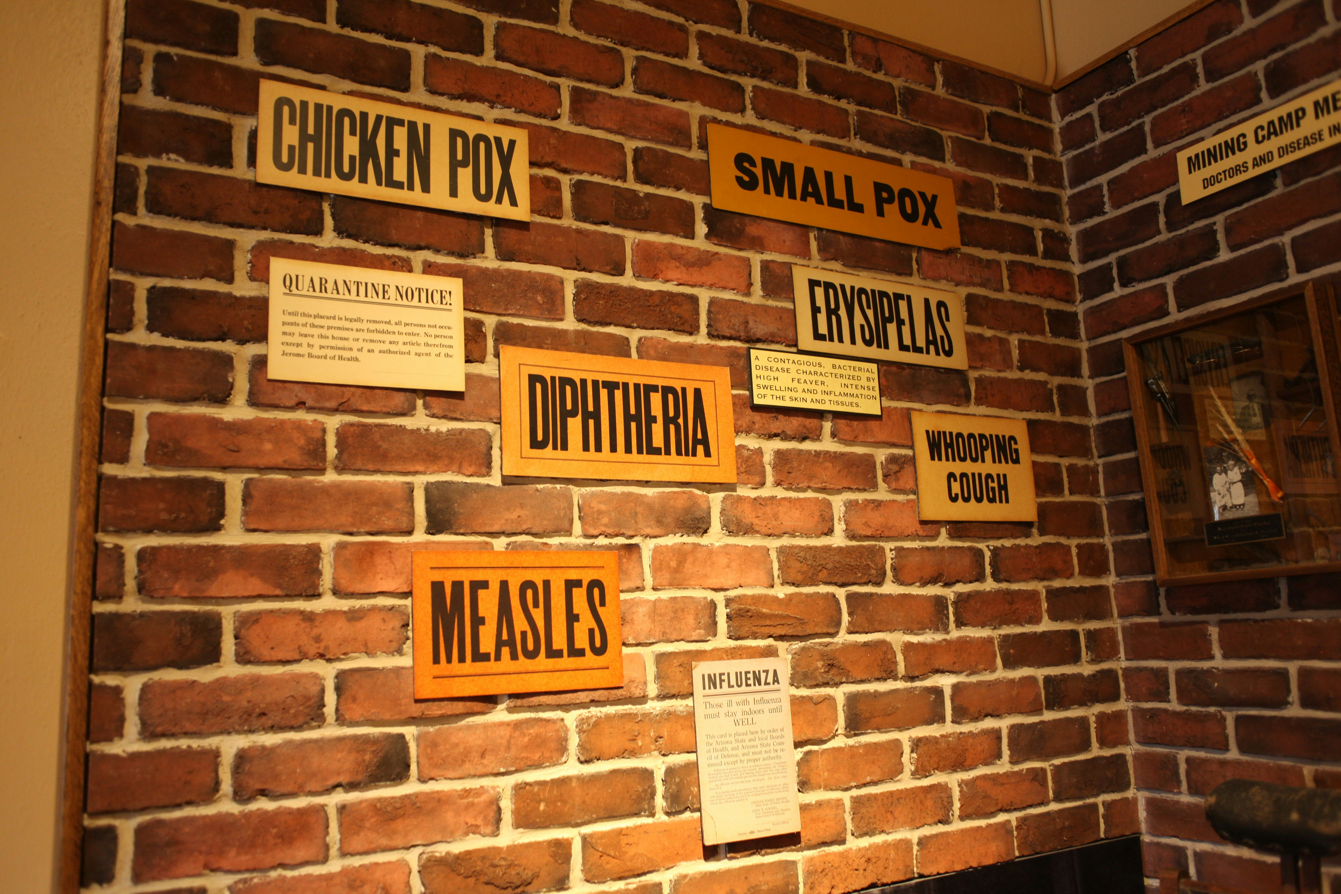 Measles Instances Rising in 34 States: Learn how to Shield Your self Throughout the Outbreak