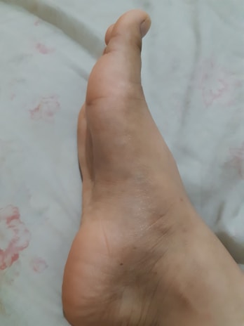 A close-up view of a bare foot resting on a light-colored, possibly floral-patterned surface. The foot is positioned at a slight angle, emphasizing the arch and heel.