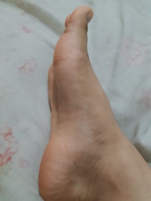 A close-up view of a bare foot resting on a light-colored, possibly floral-patterned surface. The foot is positioned at a slight angle, emphasizing the arch and heel.