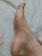 A close-up view of a bare foot resting on a light-colored, possibly floral-patterned surface. The foot is positioned at a slight angle, emphasizing the arch and heel.