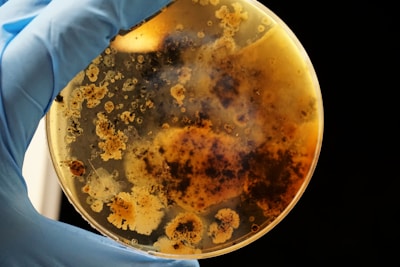 A gloved hand holds a petri dish containing various colonies of bacteria or mold. The colonies are of different shapes and sizes, predominantly displaying brown and beige colors, with a cloudy and somewhat dark appearance in certain areas.