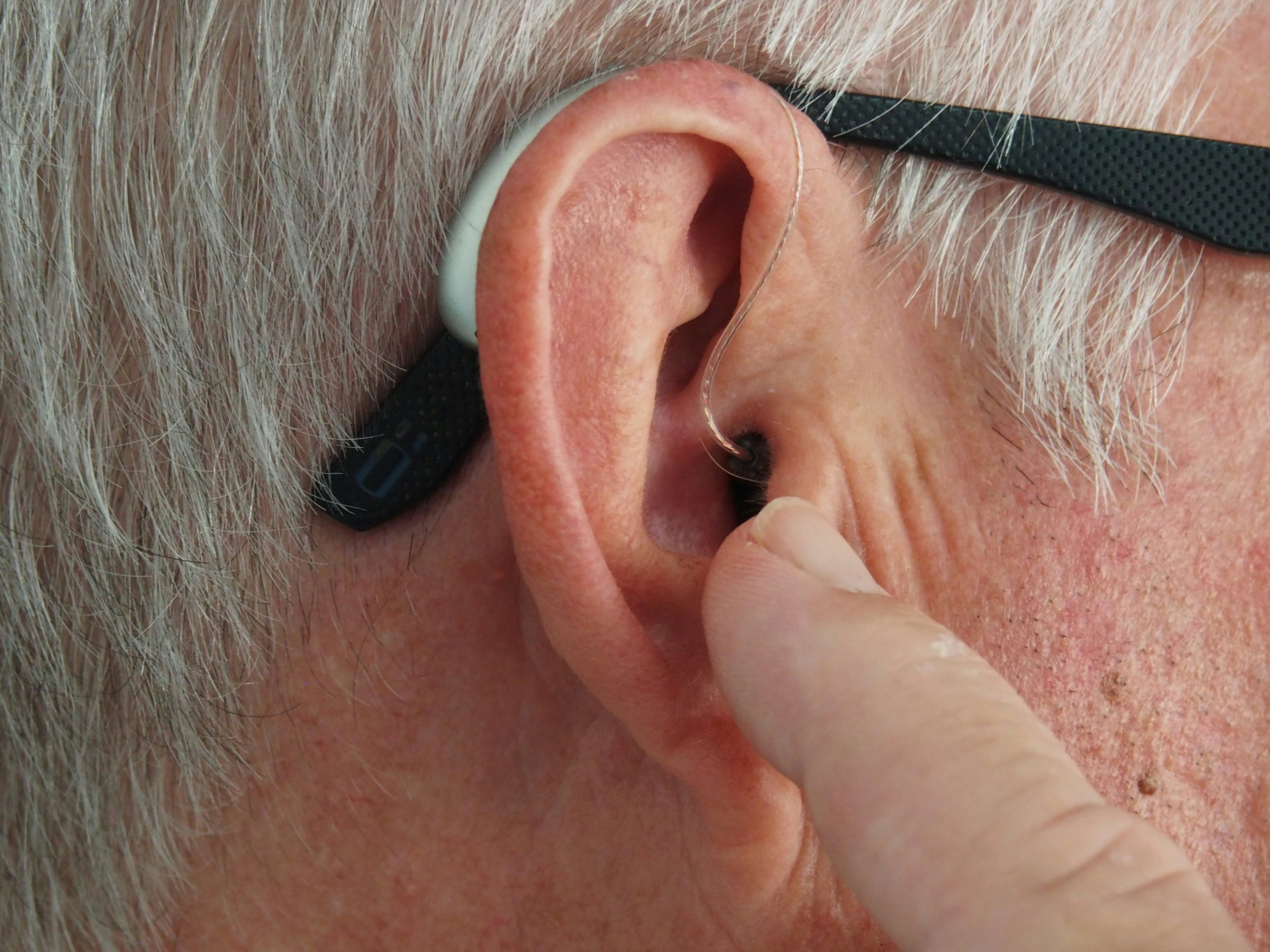 Revolutionary Breakthrough in Treating Hearing Loss