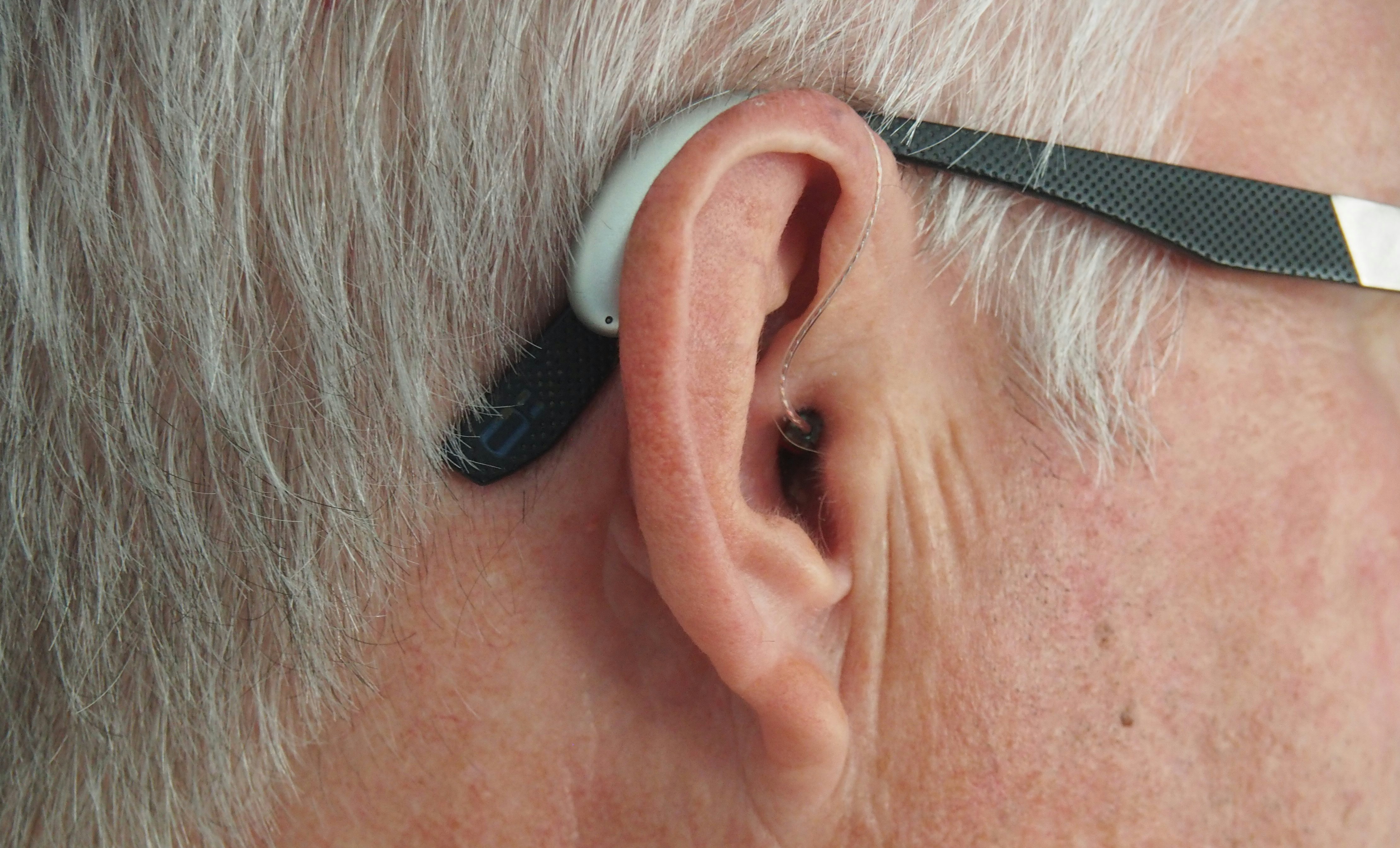 Ear hearing. Слуховой аппарат. Слуховой аппарат человека. Протезы и слуховые аппараты.