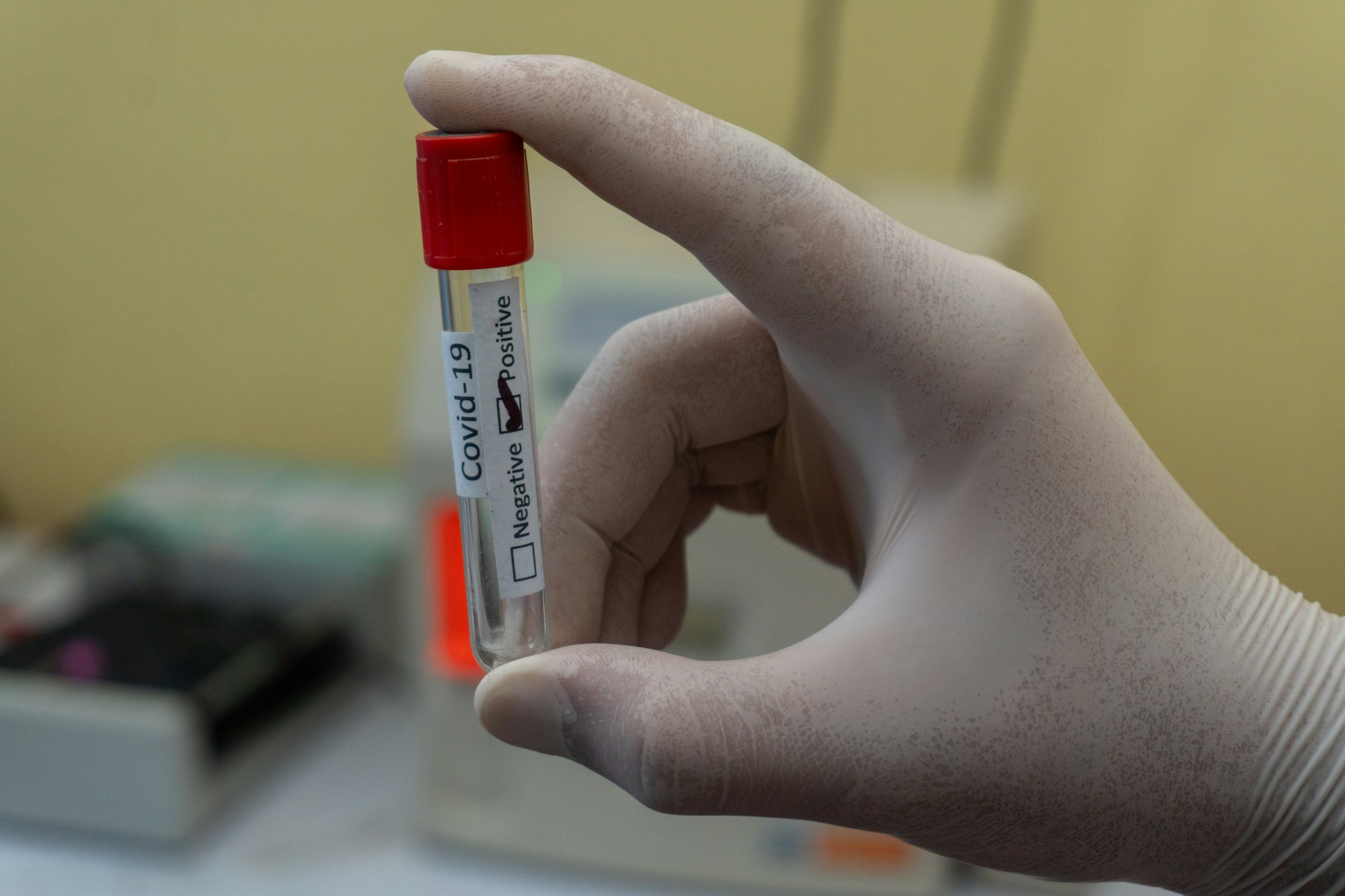 Gloved hand holding a test tube with a label indicating a positive COVID-19 result