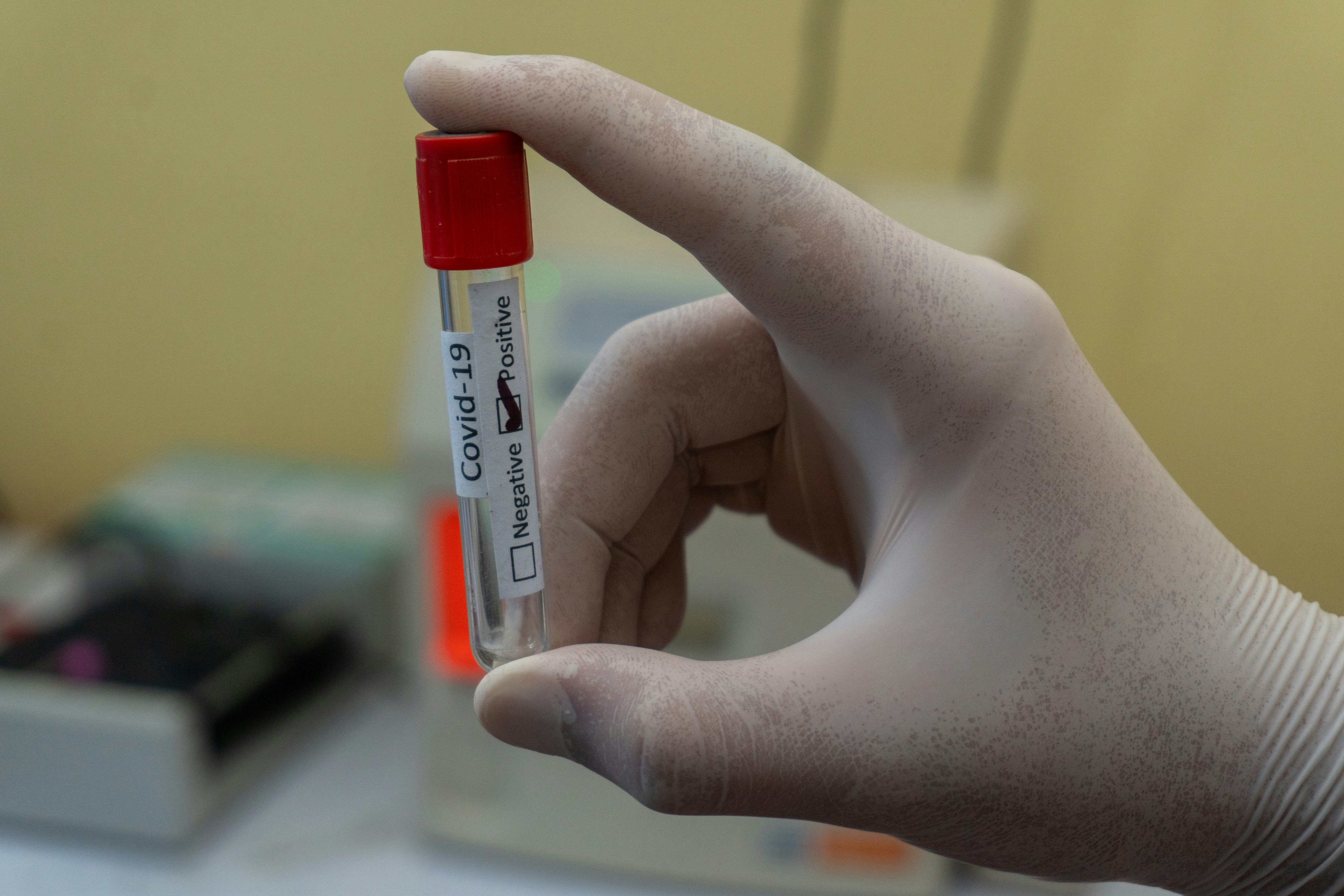 Empty blood tube with Positive Coronavirus label