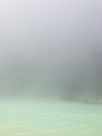 Comprehensive Guide to Alleviating Brain Fog