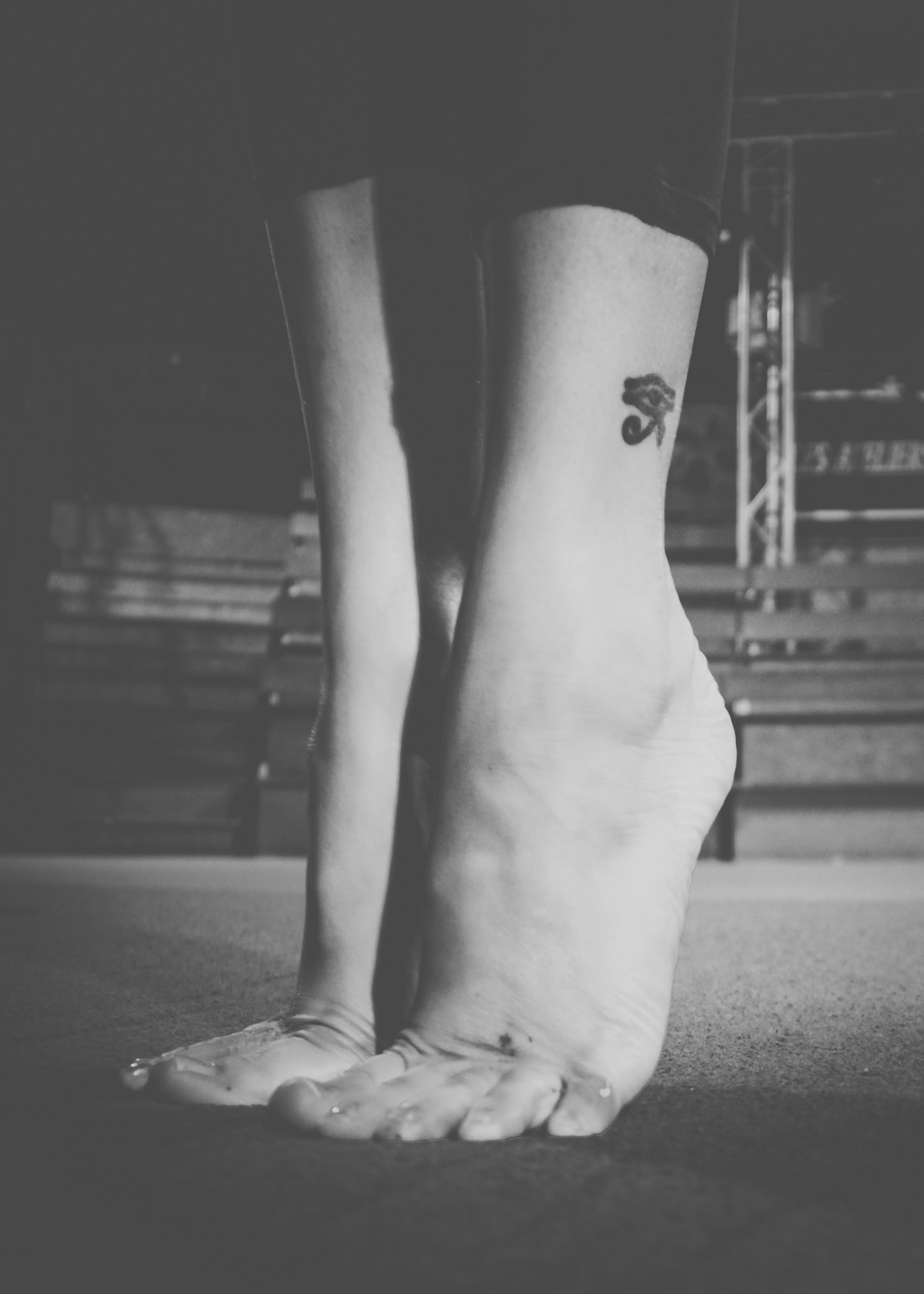 How To Correct a Hammertoe Without Surgery