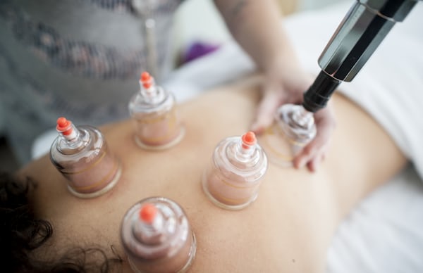 Massage Cupping