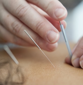 Acupuncture for women's health