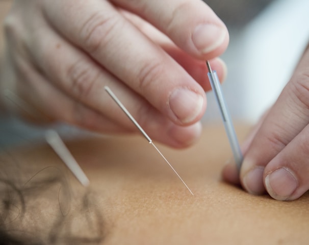 Acupuncture for women's health