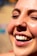 A smiling patient showcasing a bright, healthy smile after dental treatment.