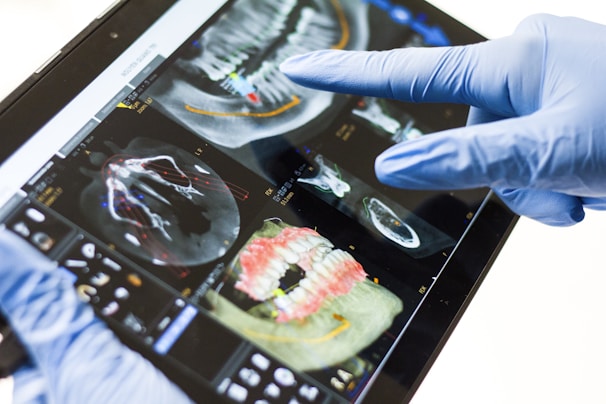 A person wearing blue medical gloves is holding a tablet displaying dental X-ray images. The screen shows various detailed scans of teeth and jaw structures with annotations in different colors.