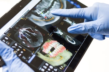 A person wearing blue medical gloves is holding a tablet displaying dental X-ray images. The screen shows various detailed scans of teeth and jaw structures with annotations in different colors.