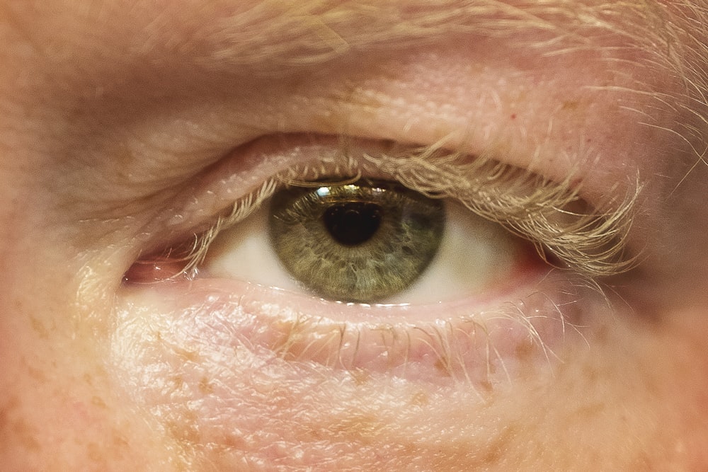 persons eye with brown eyes