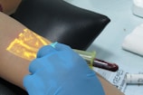 A close-up of a medical procedure where a gloved hand is using a syringe to draw blood from a person's arm. A vein finder device projects an illuminated, vascular image onto the skin to assist with the procedure.