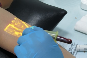 A close-up of a medical procedure where a gloved hand is using a syringe to draw blood from a person's arm. A vein finder device projects an illuminated, vascular image onto the skin to assist with the procedure.