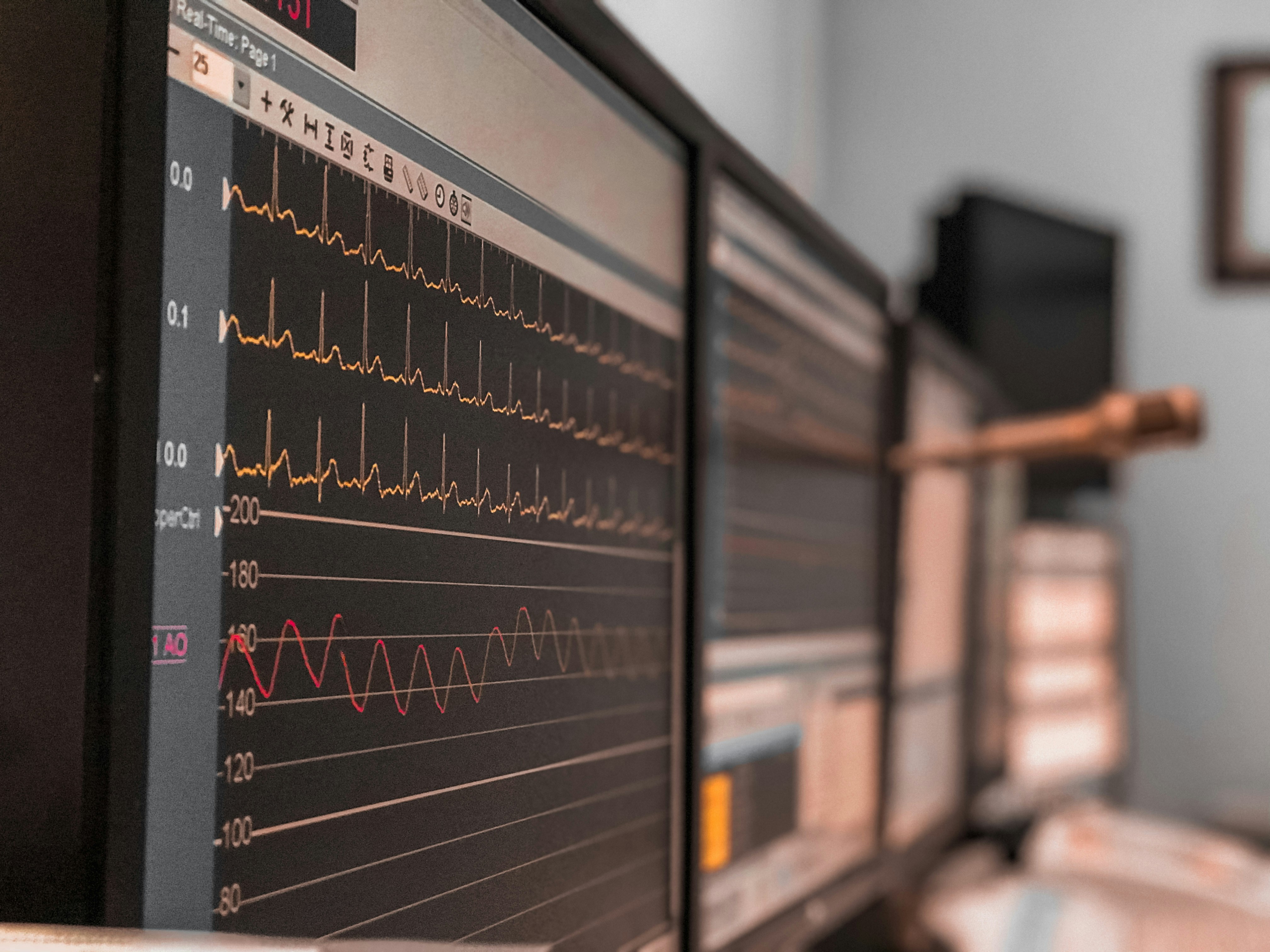 EEG monitoring equipment in dark clinical setting with glowing screens showing brain wave patterns