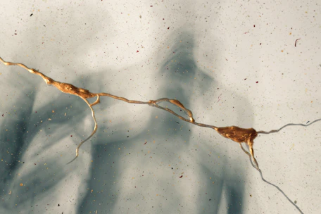 The image features a close-up view of a neuron cell with golden, branch-like extensions against a light background. The neuron is detailed, highlighting its intricate structure.