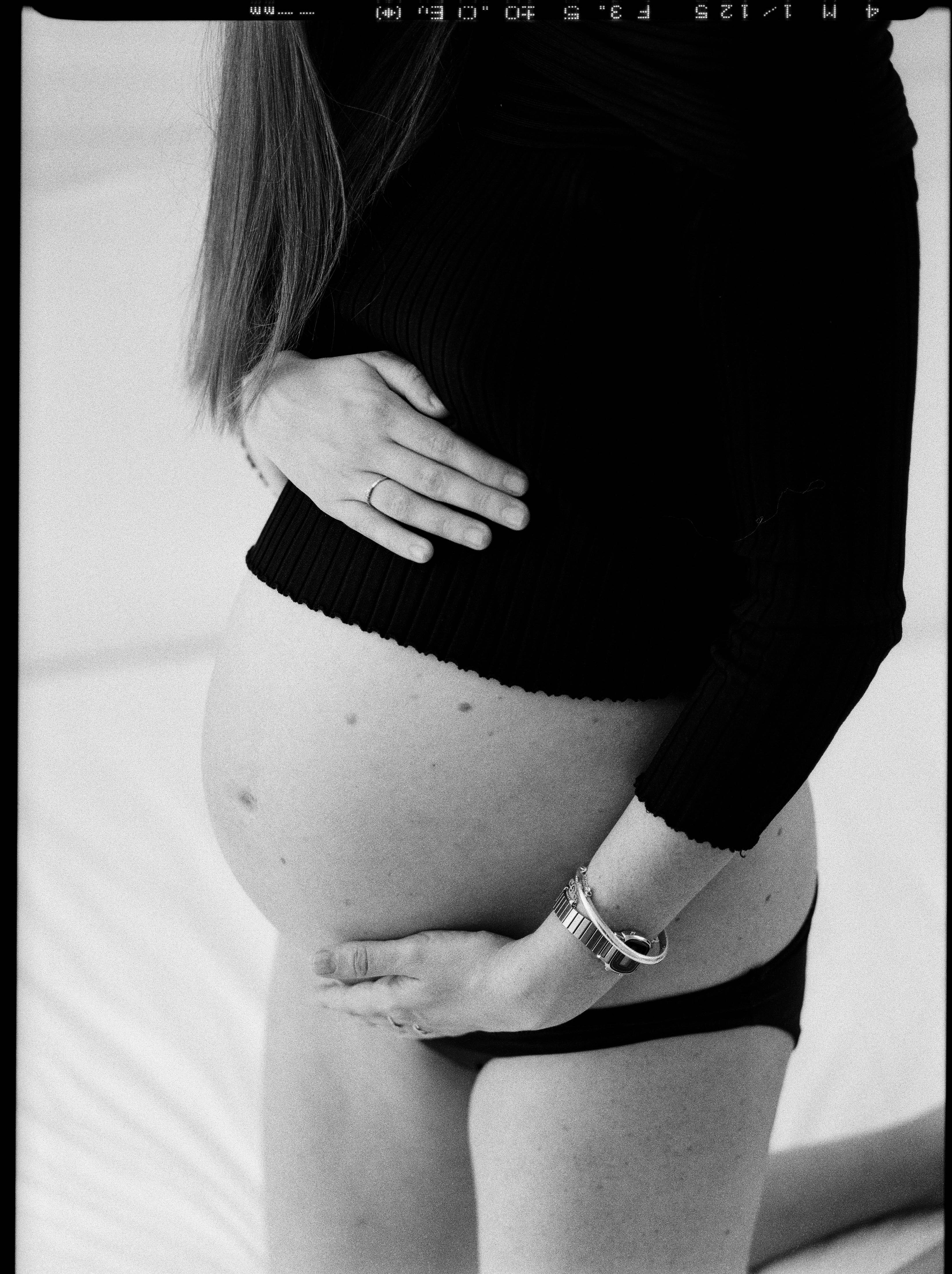 Can You Get Microneedling While Pregnant?