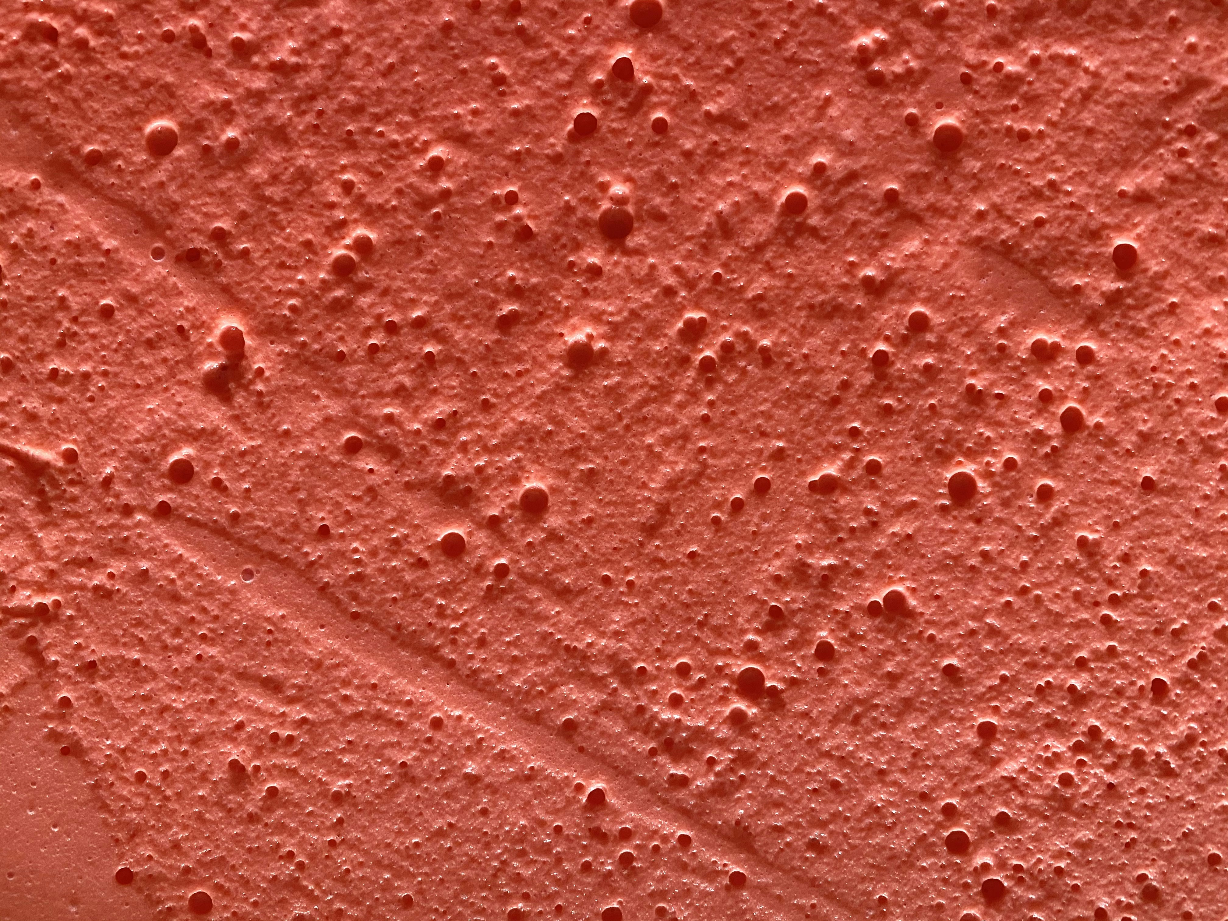 skin infection wallpaper, wallpaper, Apakah Bisul Menular? Ini Penjelasan dan Cara Mencegah Penularannya 4