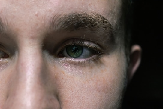 A close-up photograph of a person's face focusing on their eyes and eyebrows. The skin shows natural texture with slight imperfections, and the eye color is green with detailed visible reflections.