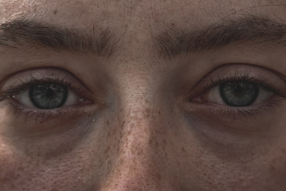 A close-up view of a person's eyes showcasing detailed textures of the skin, freckles, and eyelashes. The eyebrows are full and slightly angled, adding intensity to the gaze.